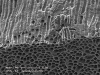 Er:YAG laser root canal debridement — study figure