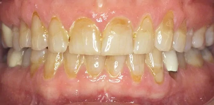 ba 01 before