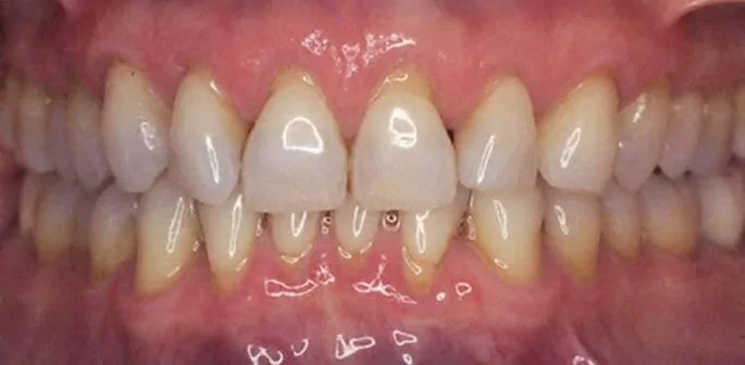 ba 02 before