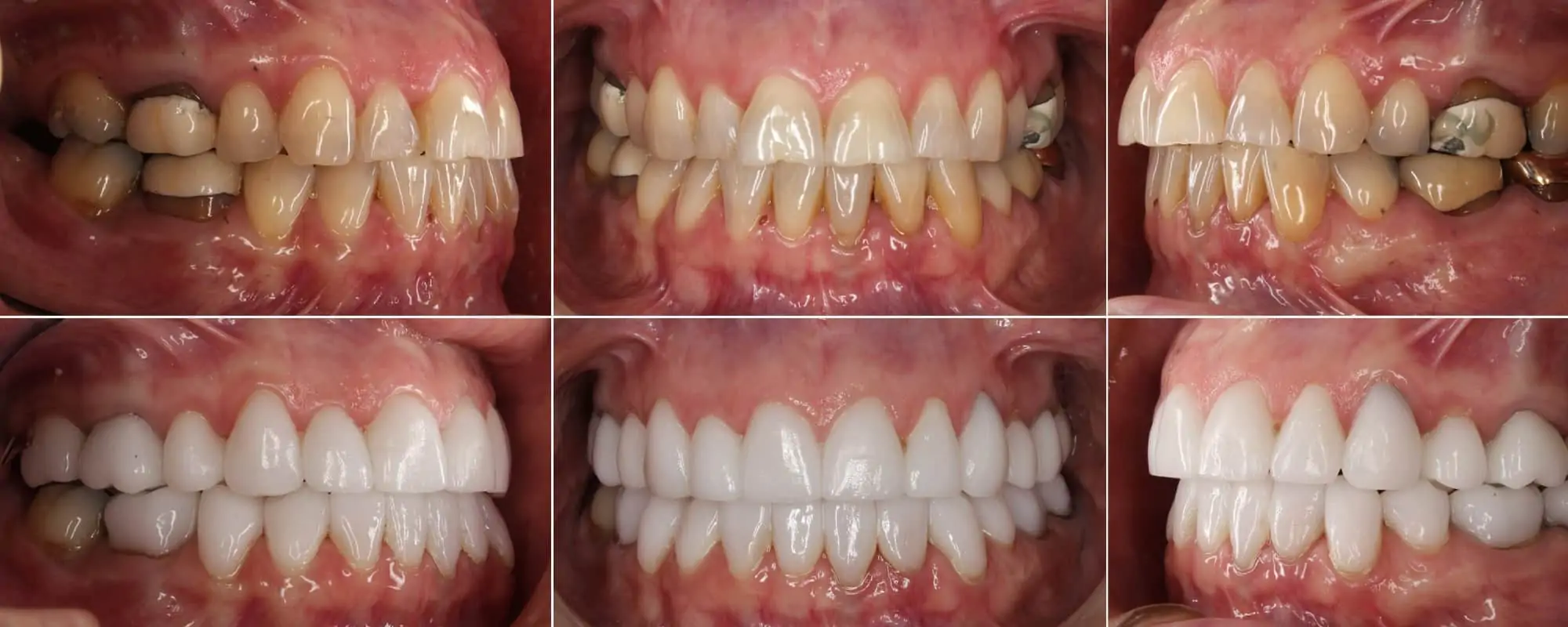 before after scottsdale cosmetic dentistry